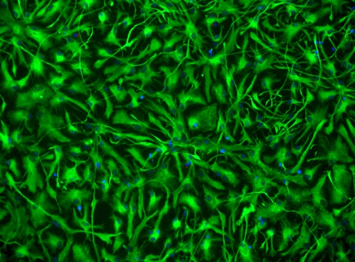 [26sk136] Endothelial Cells