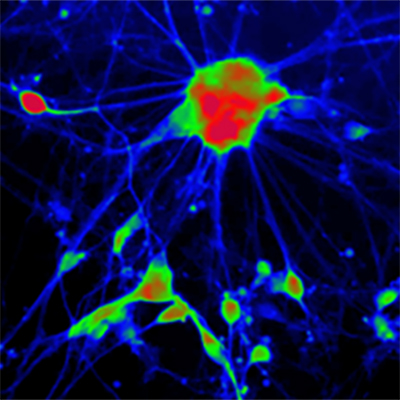 [26sk145] Reporter Cells (Spinal Motor Neurons)